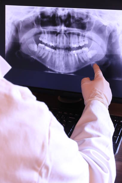 Best Emergency Treatment for Oral Infections in Nroe City, MO